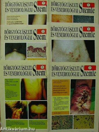 Bőrgyógyászati és venerológiai szemle 1994/1-6.