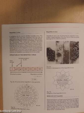 A Clinical Guide to Hepatitis