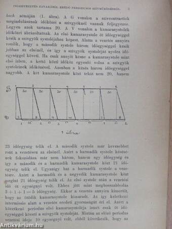 Az ingervezetés zavarából eredő periodusos szívműködésről embernél