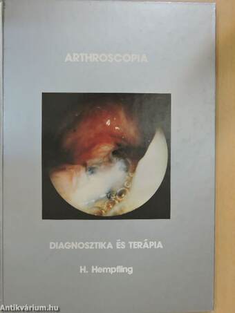 Arthroscopia