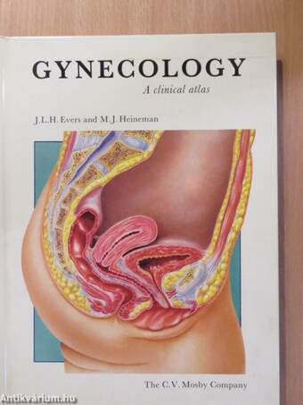 Gynecology