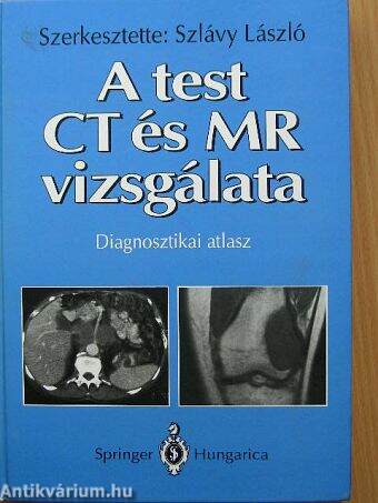 A test CT és MR vizsgálata
