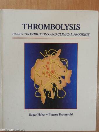 Thrombolysis