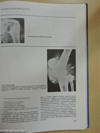 Osteoarticularis kórformák klinikai és radiológiai alapfogalmainak régiók szerinti elemzése