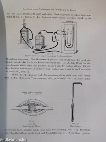 Technik der Thoraxchirurgie