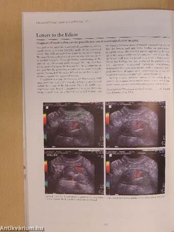 Ultrasound in Obstetrics & Gynecology May 1997