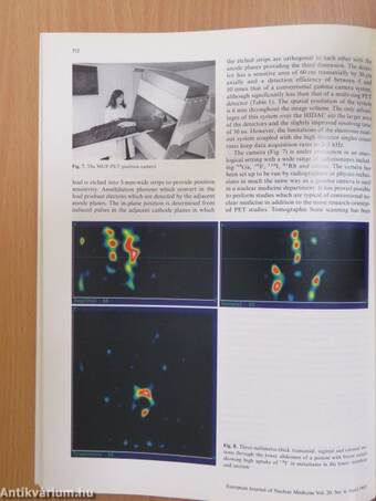 European Journal of Nuclear Medicine April 1993