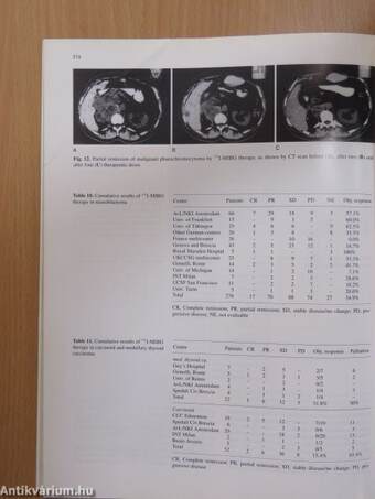 European Journal of Nuclear Medicine June 1994