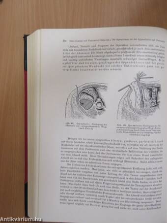 Chirurgische Operationslehre IV.