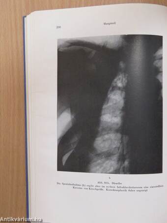 Röntgen-Grobstrukturen des Thorax