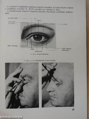 A szemészet alapvonalai 