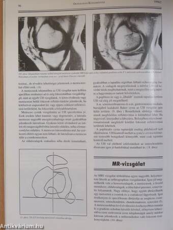 Osteologiai Közlemények 1996. május