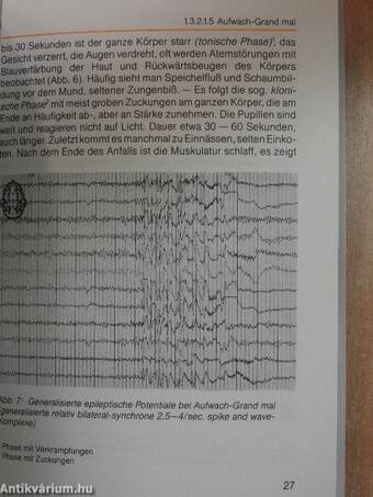 Die cerebralen Anfallsleiden - Epilepsien