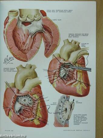 Clinical Symposia September-October 1958