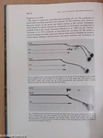 Handbook of Electroencephalography and Clinical Neurophysiology 10