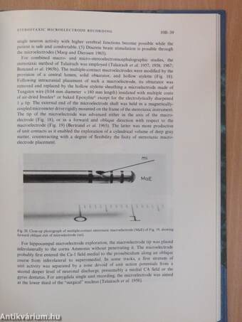 Handbook of Electroencephalography and Clinical Neurophysiology 10