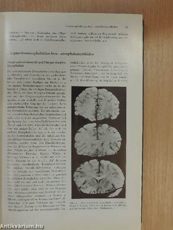 Klinische Neuropathologie