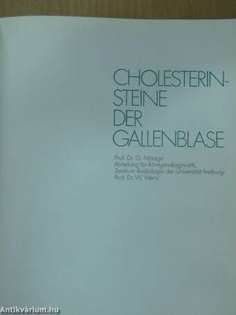 Cholesterinsteine der Gallenblase