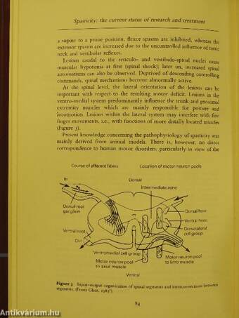 Spasticity