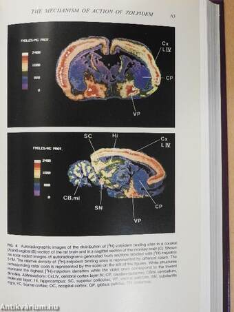 Imidazopyridines in Sleep Disorders