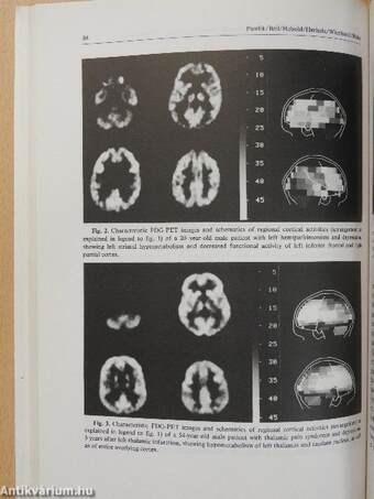 Psychopathology