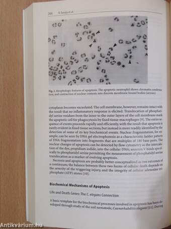 Immune Response in the Critically Ill