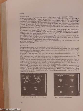 Nuclear Medicine