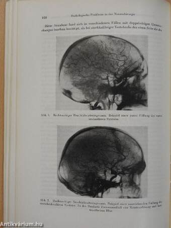 Chemische, physikalische und radiologische Probleme in der Neurochirurgie