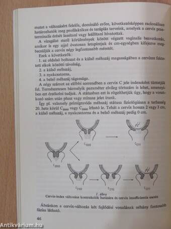 Adatok a PGF (Enzaprost - Chinoin) cervix-dilatációs hatásához