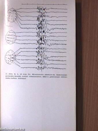 Az epilepszia mindennapi klinikai problémái (dedikált példány)