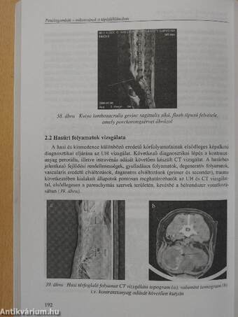 Penészgombák - mikotoxinok a táplálékláncban