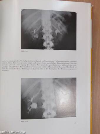 Atlas der urologischen Röntgendiagnostik