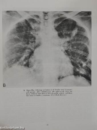 Interventional Radiology and Diagnostic Imaging Modalities