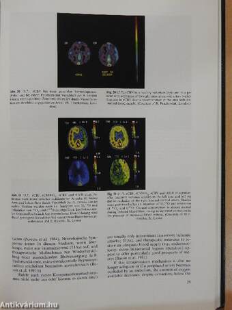 Atlas der Positronen-Emissions-Tomographie des Gehirns/Atlas of Positron Emission Tomography of the Brain