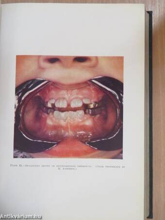 Theory and Practice of Crown and Bridge Prosthesis