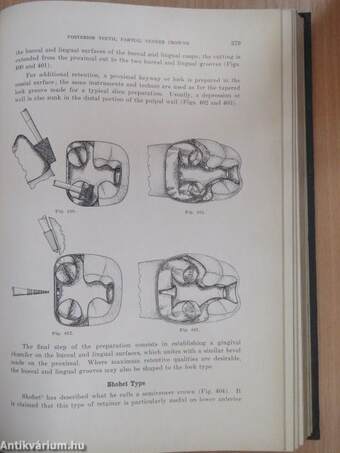 Theory and Practice of Crown and Bridge Prosthesis