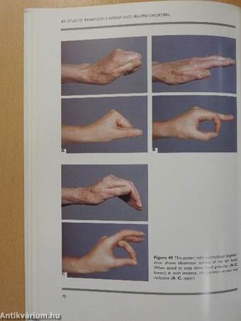 An Atlas of Parkinson's Disease and Related Disorders