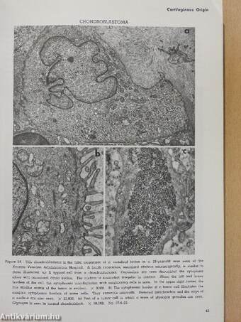 Tumors of Bone and Cartilage