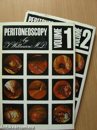 Peritoneoscopy 1-2.