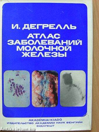 A női tejmirigyek betegségeinek atlasza (orosz nyelvű)