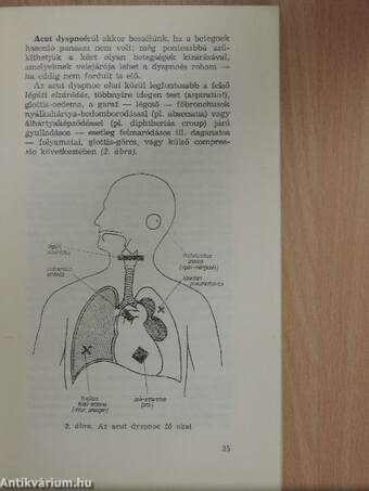 Életveszélyes állapotok körzeti orvosi ellátása