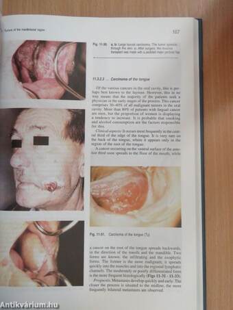 Oral and Maxillofacial Surgery