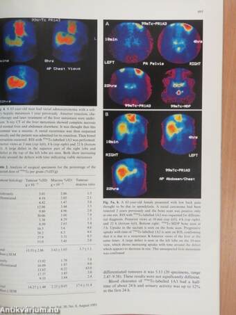 European Journal of Nuclear Medicine August 1993