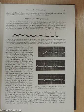 Elektrokardiographia/A szembetegségek physicotherapiája/Az állkapocssérülések gyógyítása