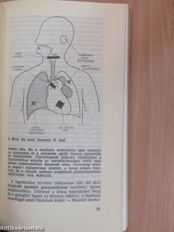 Életveszélyes állapotok körzeti orvosi ellátása