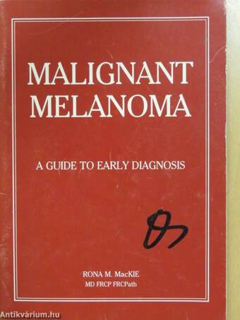 Malignant Melanoma