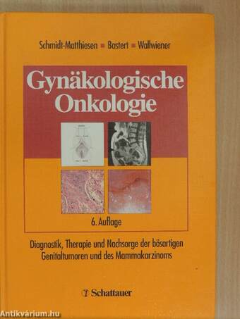 Gynäkologische Onkologie