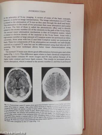 Imaging of Infections and Inflammations of the Central Nervous System: Computed Tomography, Ultrasound, and Nuclear Magnetic Resonance