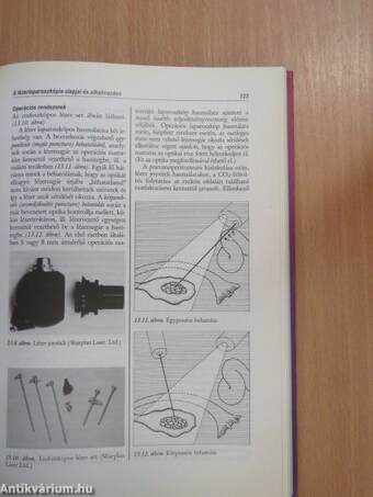 Nőgyógyászati endoszkópia