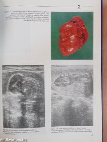 Atlas of Fetal Diagnosis